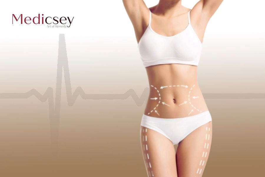 Liposuction Cost in Turkey The Cheapest Options in 2023